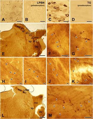 Synaptic connectivity of the TRPV1-positive trigeminal afferents in the rat lateral parabrachial nucleus